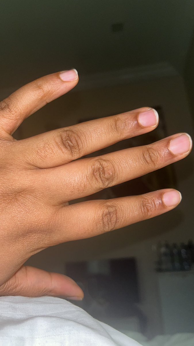 MimiObehi's tweet photo. @Solomon_Buchi Name  - Miriam
Religion- Christianity 
Occupation - Facility Manager
Location - Abuja
Genotype - AA

P.s - There’s a pic of my hand just so ring size isn’t a problem 😌😉 https://t.co/wjmIprwkfV