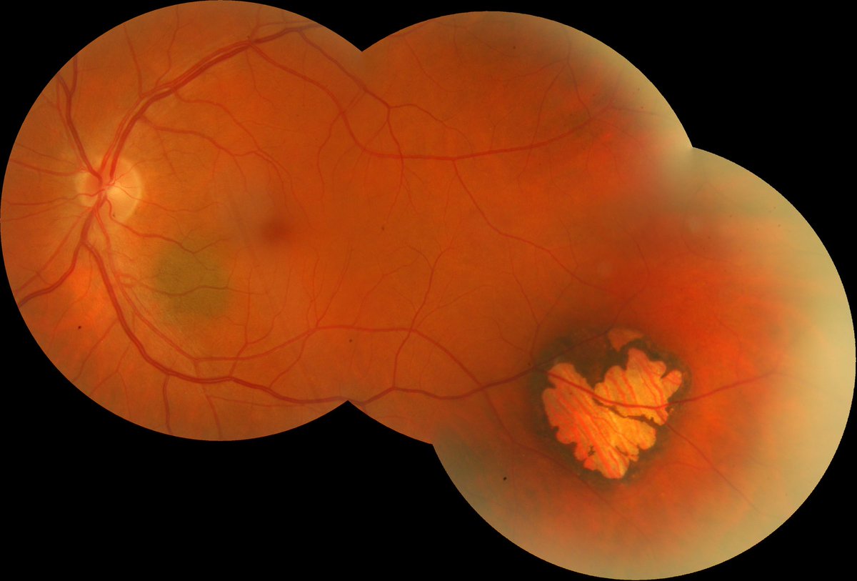 Kye Layton tweet media