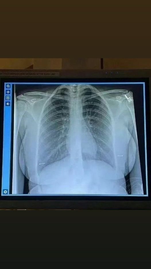 JimmyBeh 🦇🔊 tweet media