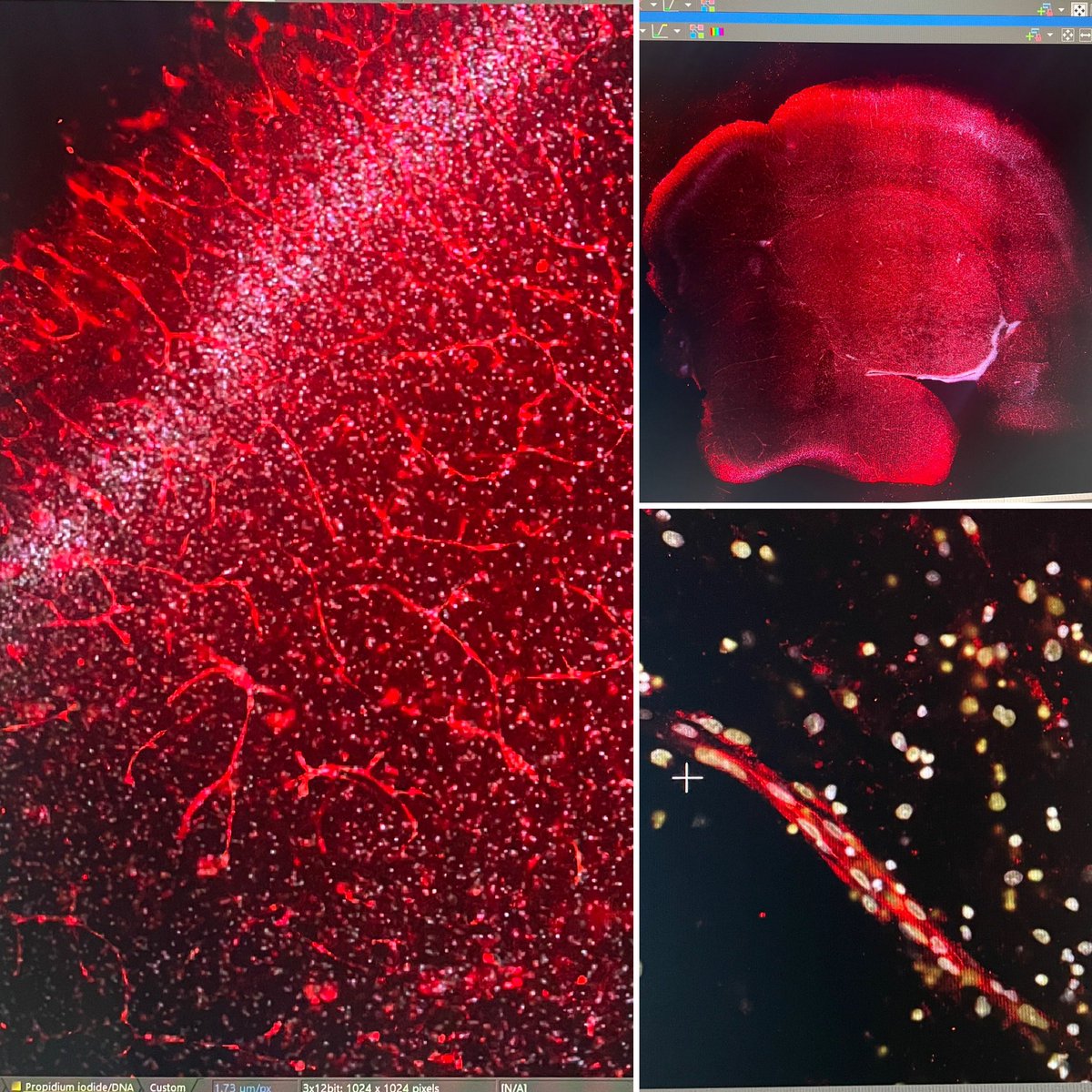 Sydney Floryanzia 👑 (@neurochemequeen) on Twitter photo <a href="/SigmaAldrich/">Sigma-Aldrich</a> 🌹Vessels are red,
💙 DAPI is blue…
When you’re imaging brain cells
and brain slices too! 🔬
Happy #Vday ❣️❤️
(the V stands for #vasculature right??)
#bloodbrainbarrier #bbb #fluorescence #microscopy #neurovasculature #brain #SigmaAldrichChocolate <a href="/SigmaAldrich/">Sigma-Aldrich</a> 🌹Vessels are red,
💙 DAPI is blue…
When you’re imaging brain cells
and brain slices too! 🔬
Happy #Vday ❣️❤️
(the V stands for #vasculature right??)
#bloodbrainbarrier #bbb #fluorescence #microscopy #neurovasculature #brain #SigmaAldrichChocolate