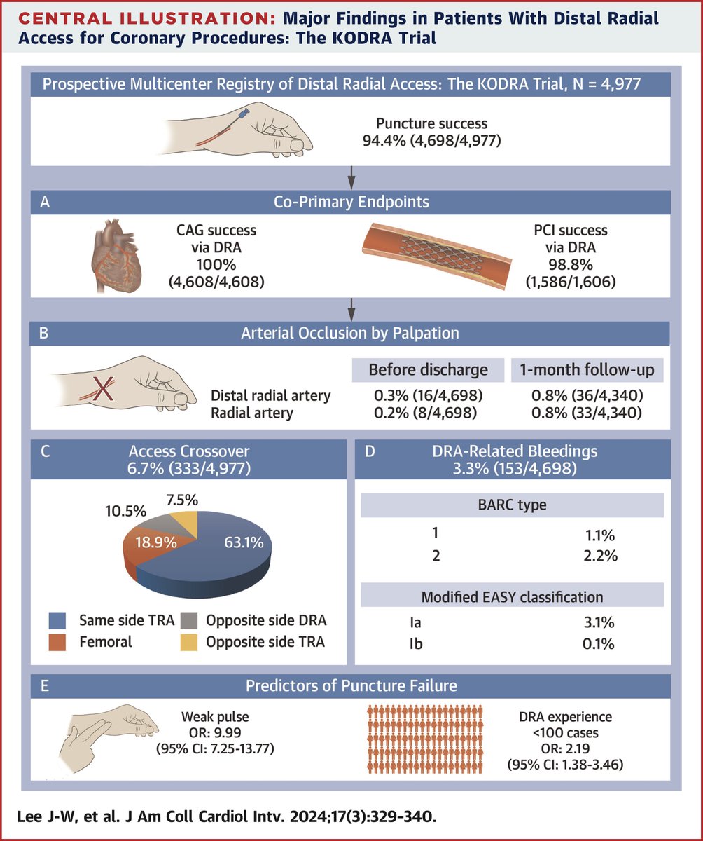 The largest distal radial access study to date confirms in a real-world setting the high success rate and impressively low incidence of radial artery occlusion previously seen in the DISCO RADIAL randomized trial.
#DistalRadialFirst #JACCINT #RadialFirst 

sciencedirect.com/science/articl…