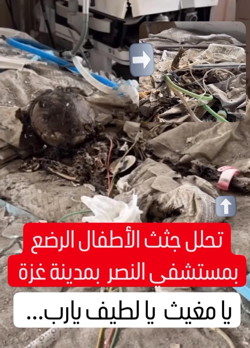 Decomposition of the bodies of infants at Al-Nasr Hospital in Gaza