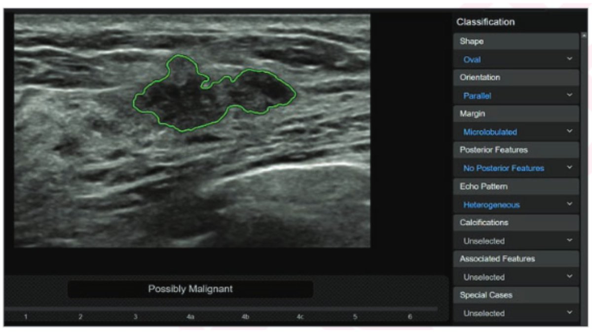 New <a href="/AJR_Radiology/">AJR</a> Accepted Manuscript:

"Artificial Intelligence for Breast Ultrasound: AJR Expert Panel Narrative Review"

By Drs Bahl, <a href="/jungmin_chang/">Jung Min Chang</a>, Mullen, &amp; <a href="/DrWendieBerg/">DrWendieBerg</a> 

ajronline.org/doi/10.2214/AJ…
