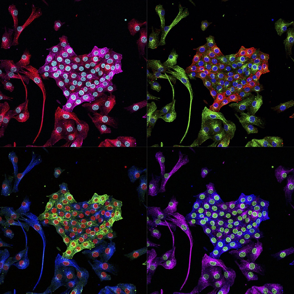 ❤️En ce jour de #StValentin
voici "Pop(He)art"
Prix Myoimage 2023 de la <a href="/SMyologie/">SFMyologie</a>
Crédits: Anna Rausch De Traubenberg 
de l'équipe de <a href="/vgache007/">Gache vincent: MNCA team at NeuroMyoGene Institute</a> <a href="/iNeuroMyoGene/">InstitutNeuroMyoGène</a> 
<a href="/NikonFR/">Nikon France</a>
