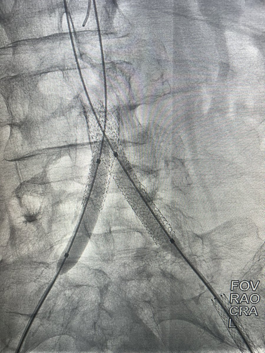Happy Valentine’s Day!! <a href="/UICOMPRadiology/">UICOMP Radiology</a> <a href="/SIRRFS/">SIR RFS</a> <a href="/SIR_ECS/">SIR ECS</a>