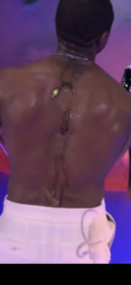 GroundZeroGG's tweet photo. @Michell69397997 You have lost the plot, The yellow line is the microphone wire going down his back and the red circles are the body tape holding it in place please go touch grass https://t.co/U180ZpUdx1