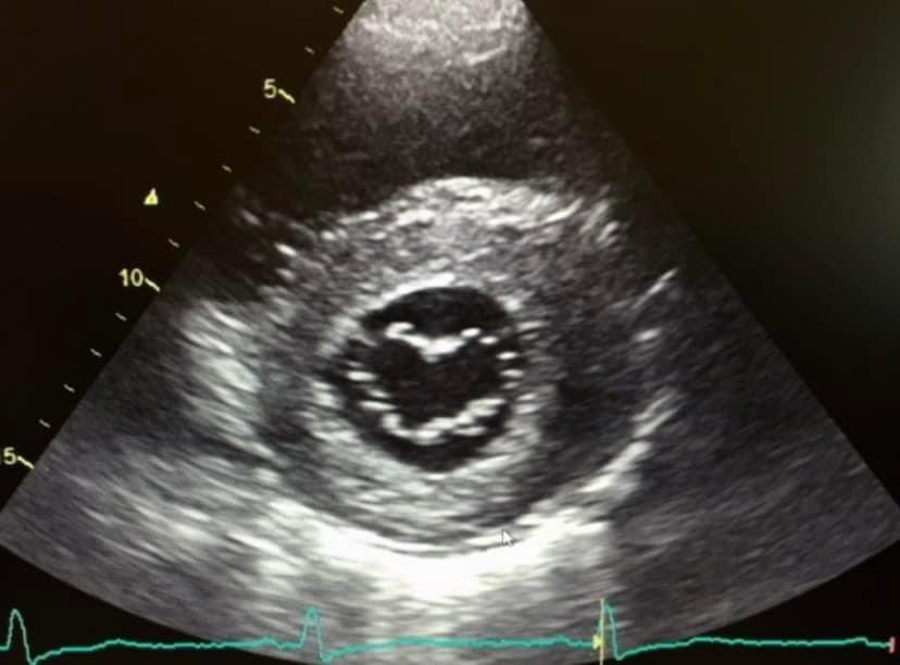 ASE360's tweet photo. "Roses are red,
Not green like a gecko.
Let's spend the day
Looking at an echo." 🫀
#HappyValentinesDay #ASEHeart https://t.co/qgTiSqv1eY