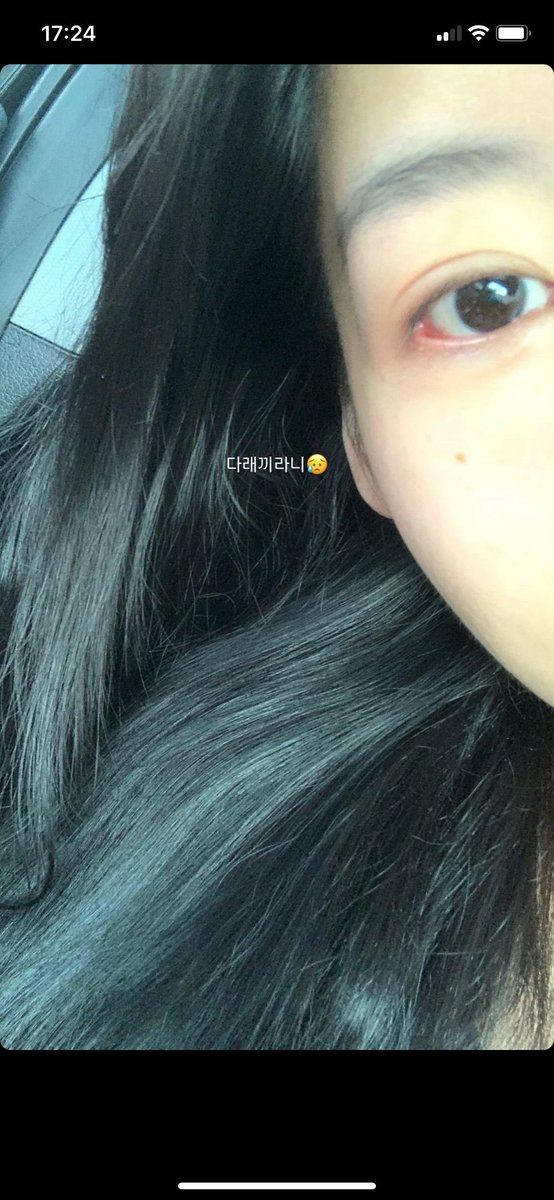 ASchoolBR's tweet photo. 📷 14.02.24 | Atualização da #RAINA nos stories de seu Instagram:

“@.tuneclinic Já faz muito tempo!!
Sempre amigável Wonwon e equipe 🫶🏻”

#afterschool #애프터스쿨 #레이나 https://t.co/jWo7FLimHV