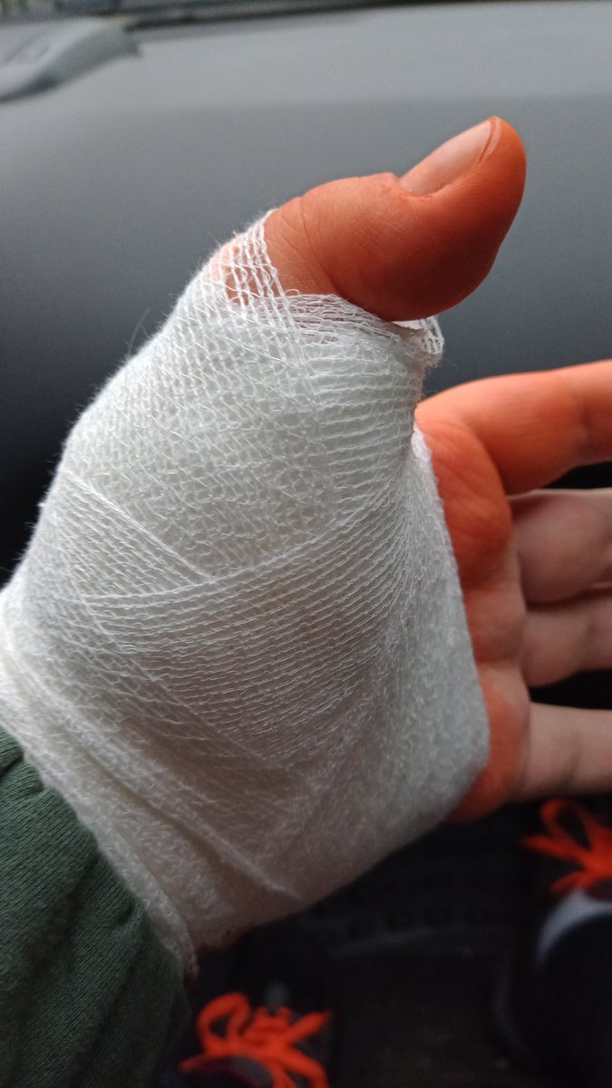 hajek_jaromir's tweet photo. Today Tomb Raider Remastered trilogy released. But i cant play 🥺 #TombRaiderRemastered #tombraider #laracroft #triggerfinger #brokenfinger #eidos #aspyr #CRYSTALDYNAMICS https://t.co/f7C1lirkE8
