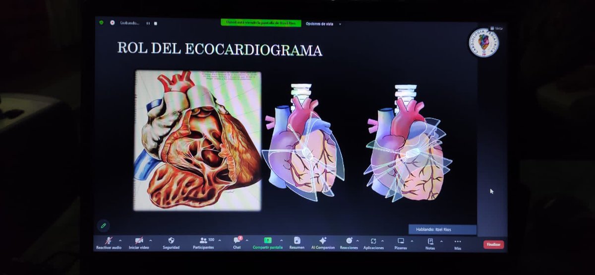 HIAyoraLoja's tweet photo. #EstoEsEcuador | Los avances tecnológicos han permitido que las cardiopatías congénitas sean estudiadas a profundidad y tratadas con oportunidad. Así lo expresan especialistas en cardiología pediátrica durante el #Webinar del @HIAyoraLoja https://t.co/RfXj6fM2S6
