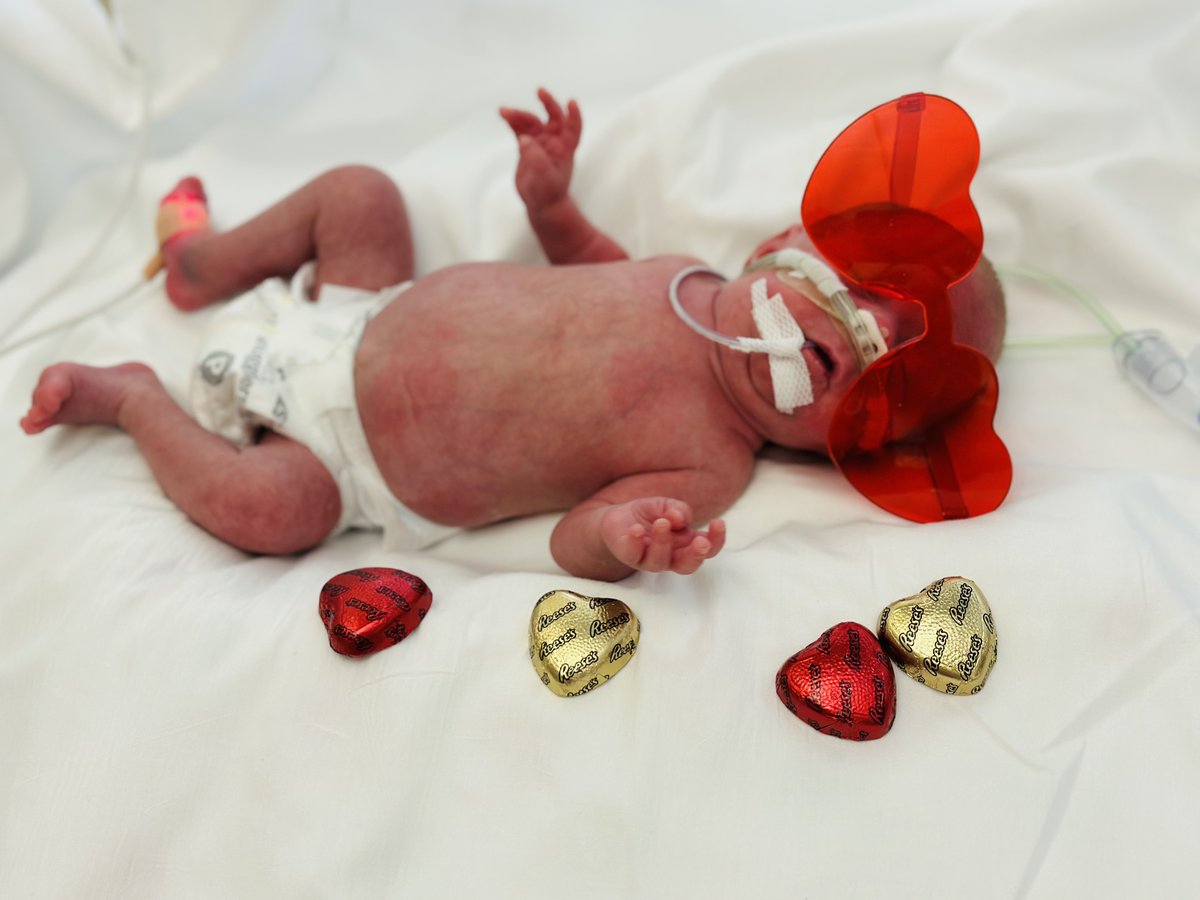 WBRCnews's tweet photo. These Brookwood Baptist Medical Center NICU babies dressed up for Valentine’s Day surely brightened our day! The adorable costumes were provided by NICU nurses. 💕👶

Share your pics with us here >> https://t.co/SgAOucLF1o https://t.co/6BbGgxqPRJ