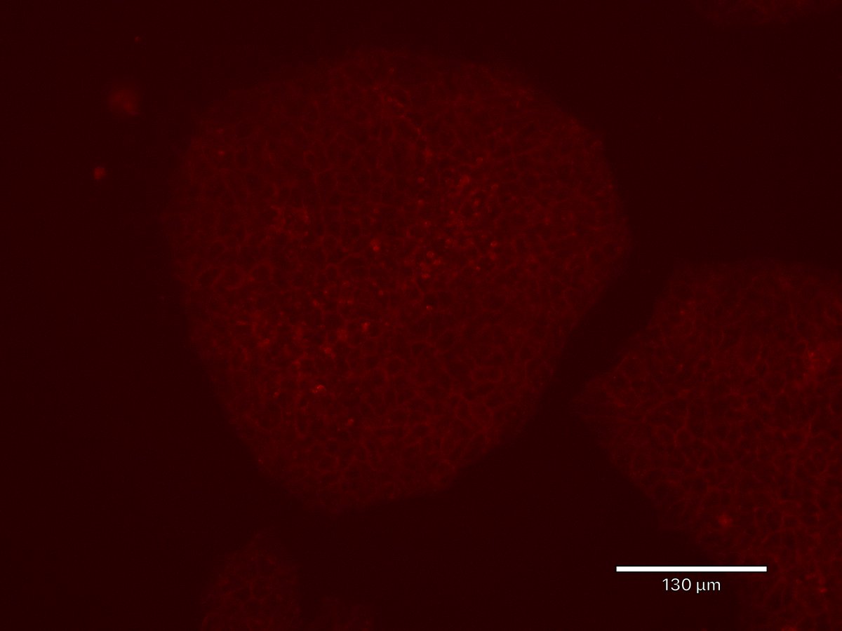SciWhye23's tweet photo. Happy Valentine's Day from the #RSZTNC #HumanNeuronCore! #inducedpluripotentstemcells #hiPSCs #redfluorescentprotein #plasmamembrane @AllenInstitute @Coriell_Science @FMKirbyNeuro @BCHStemCell @BostonChildrens @iddrc_bch https://t.co/HxBmMOWFjJ