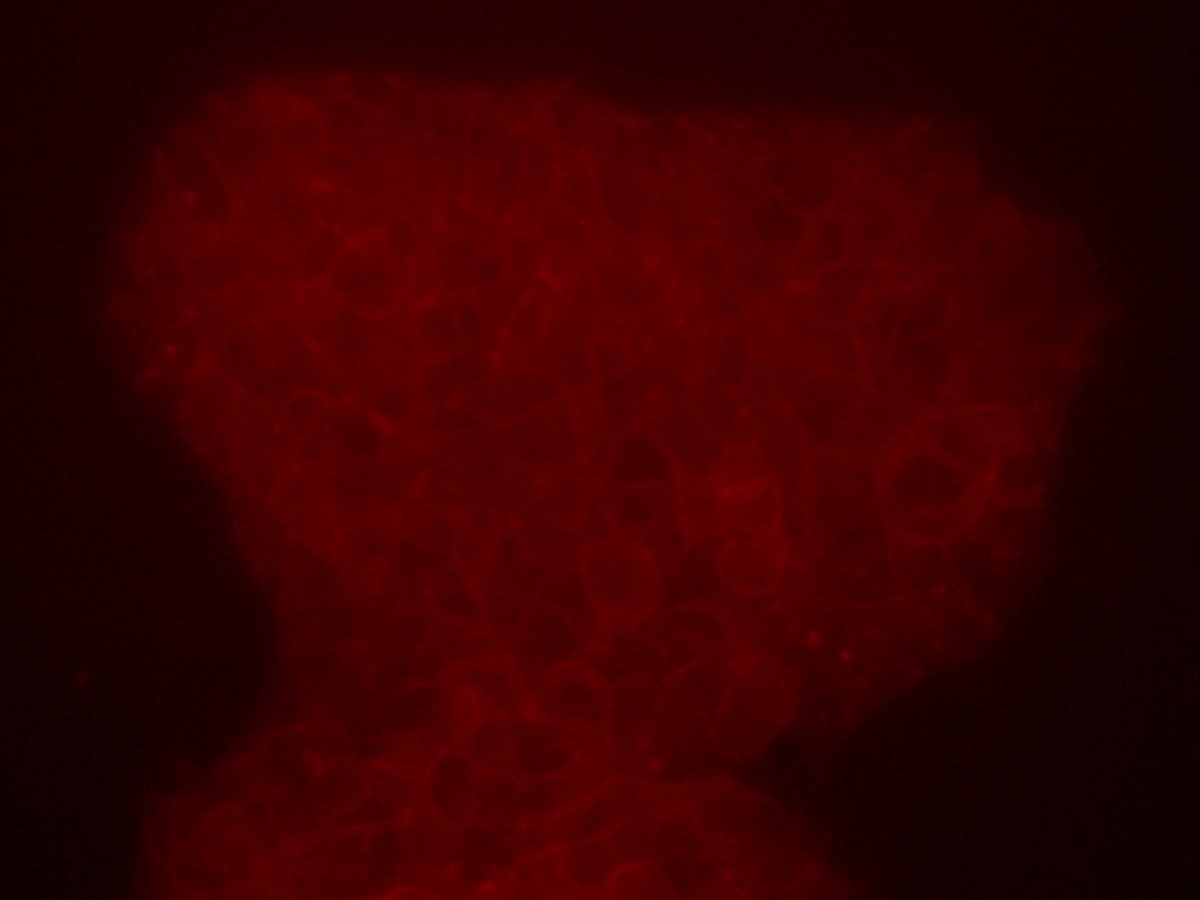 SciWhye23 (Dosh Whye) (@sciwhye23) on Twitter photo Happy Valentine's Day from the #RSZTNC #HumanNeuronCore! #inducedpluripotentstemcells #hiPSCs #redfluorescentprotein #plasmamembrane <a href="/AllenInstitute/">Allen Institute</a> <a href="/Coriell_Science/">Coriell Institute</a> @FMKirbyNeuro @BCHStemCell <a href="/BostonChildrens/">Boston Children's</a> <a href="/iddrc_bch/">Intellectual & Dev Disabilities Research Center</a> Happy Valentine's Day from the #RSZTNC #HumanNeuronCore! #inducedpluripotentstemcells #hiPSCs #redfluorescentprotein #plasmamembrane <a href="/AllenInstitute/">Allen Institute</a> <a href="/Coriell_Science/">Coriell Institute</a> @FMKirbyNeuro @BCHStemCell <a href="/BostonChildrens/">Boston Children's</a> <a href="/iddrc_bch/">Intellectual & Dev Disabilities Research Center</a>