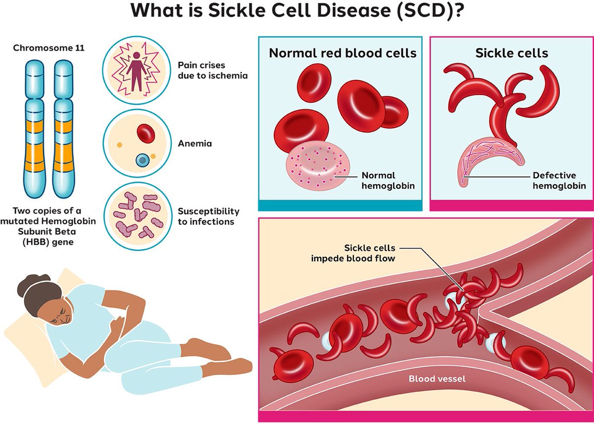 analgesicsleep's tweet photo. “A Warm December” was the first major film to mention sickle cell disease 
#MusComEnt #AWarmDecember https://t.co/m2qb6xFdzN