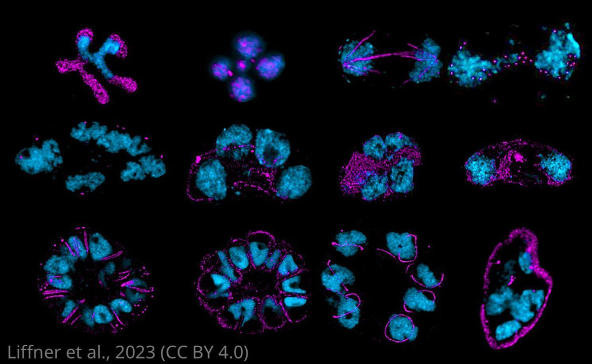An unprecedented atlas of the subcellular organisation of #malaria parasites using expansion microscopy. #ReviewedPreprint #Plasmodium #Microbiology elifesciences.org/reviewed-prepr…