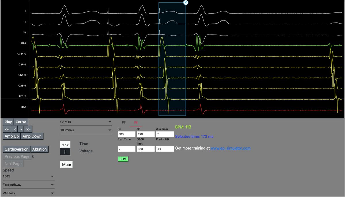 Assessment of novel electrophysiology simulator—a survey study dlvr.it/T2mXSW