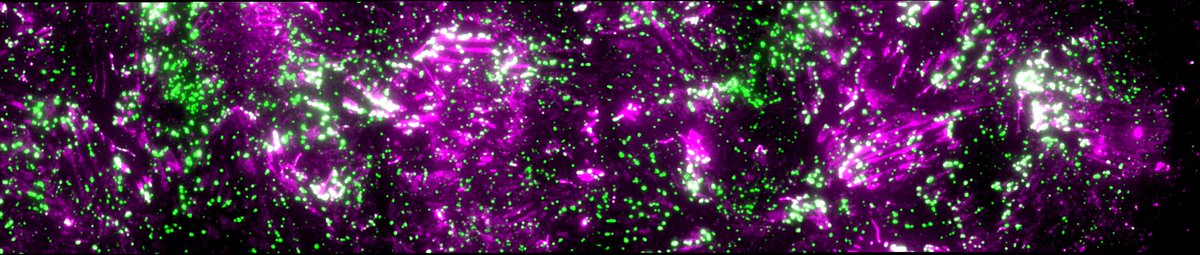 HakanpaaLaura's tweet photo. Grateful for the continued support towards my science on new #celladhesion s in #cancer #metastasis @Skr_fi 💓 #kulttuurirahastontuella #skr2024 Work continues with @Leonardo_ASouza @BIOTECH_UH @MIBS_Helsinki @BioEnvHelsinki https://t.co/H50zQLyqZg