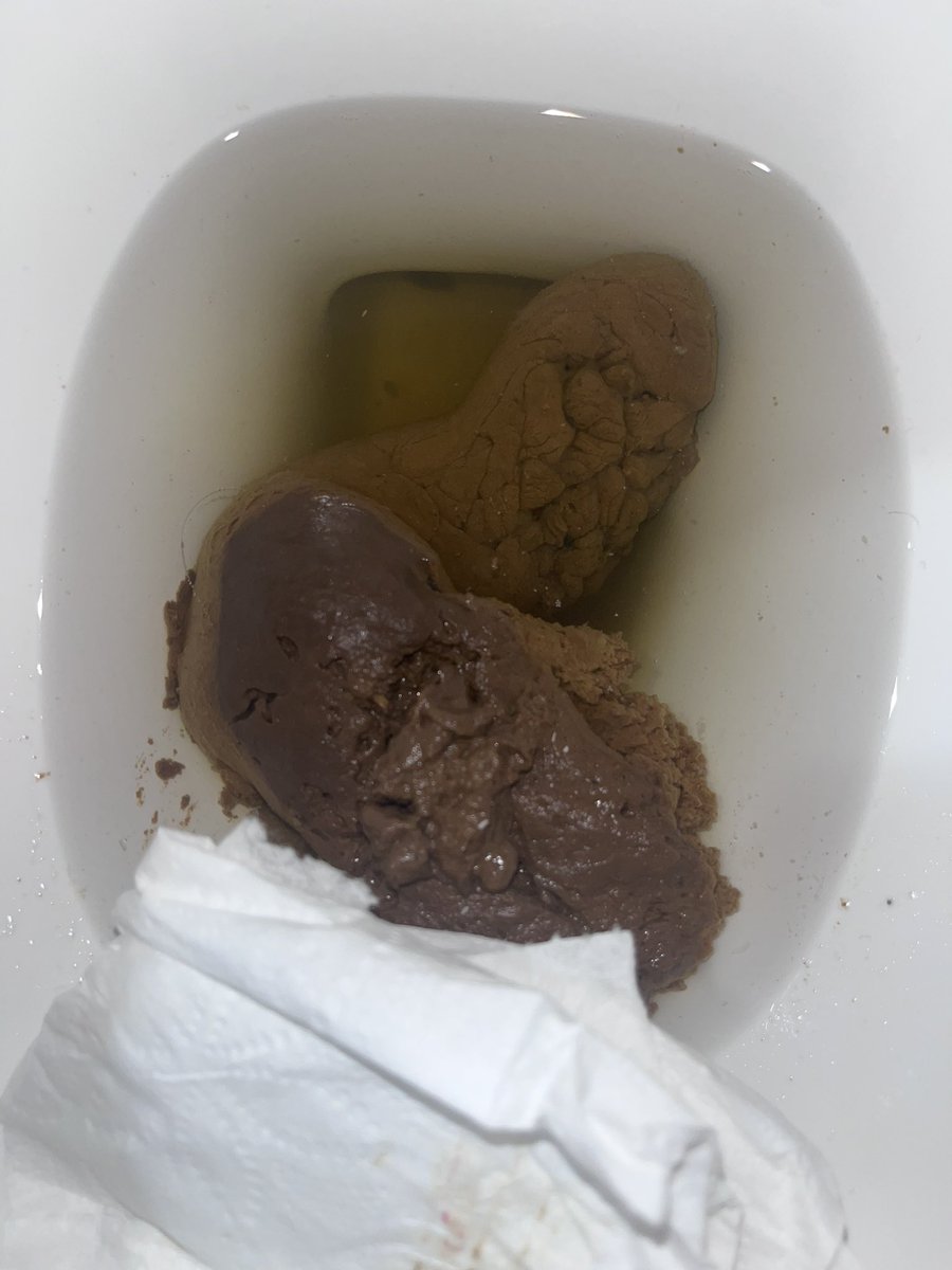 I1ovep00p's tweet photo. This poop was very smelly and it felt amazing coming out #dump #faggotboy #gay #gayscat #horny #ilovepoop #kink #poop #porn #scat #shit https://t.co/lR5neXDtqW