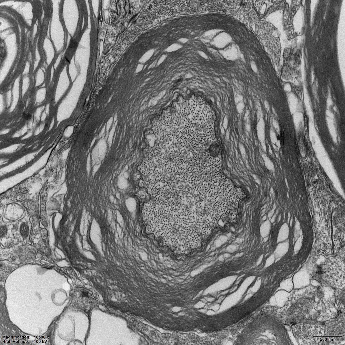 ProjectNemi's tweet image. 🕸  &quot;The Fragile Web of Life&quot; by Anita Grootemaat from Amsterdam UMC (@amsterdamumc).

🔎#TransmissionElectronMicroscopy image showing deformation of the #myelin sheath with gaps between tangent layers.

🔬 Imaged with a FEI Tecnai T12 #TEM  (@thermosci)

#Microscopy #AMC