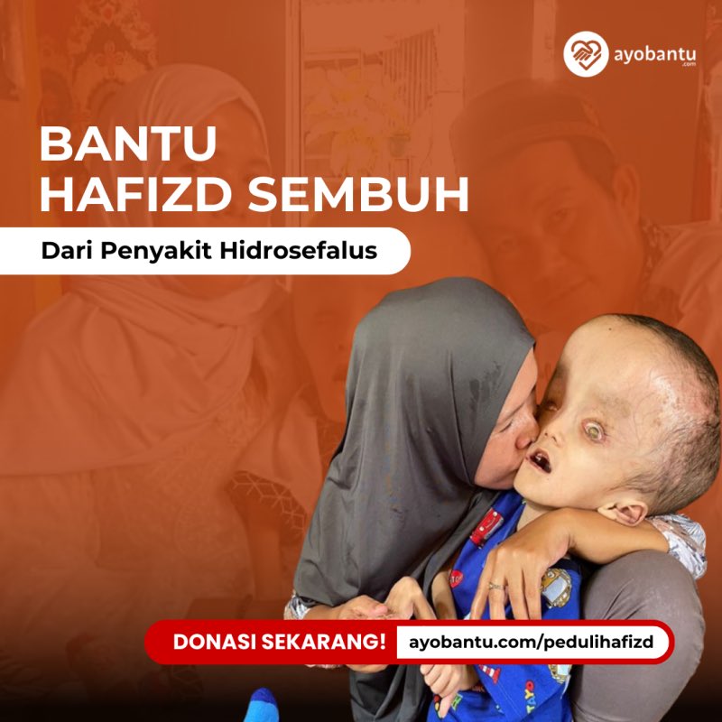 ayobantucom's tweet photo. Bantu Hafidz sembuh dari Hidrosefalus

https://t.co/GoidDHtWSK https://t.co/btu40P4iJG