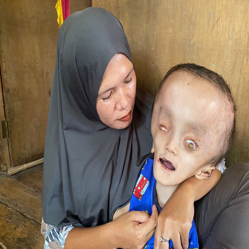 ayobantucom's tweet photo. Bantu Hafidz sembuh dari Hidrosefalus

https://t.co/GoidDHtWSK https://t.co/btu40P4iJG
