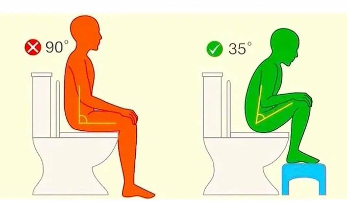 pharmahub_'s tweet photo. "Why Squatting Might Be the Key to a Healthier Digestion" 🤔

The benefits of the squatting position may include :

🔸Alignment: The squatting position can align the rectum and anal canal in a straighter position, which may aid in a smoother bowel movement.

🔹Ease of Passage: Squatting can increase the anorectal angle, allowing for easier passage of stool.

🔸Reduced Strain: This position can reduce straining and pressure in the anal and rectal veins, potentially lowering the risk of hemorrhoids.

🔹Complete Evacuation: It might help in more complete evacuation of the bowels, reducing constipation.

This is based on the idea that humans are anatomically designed to squat to eliminate, and modern toilets don't always promote the optimal position for defecation.