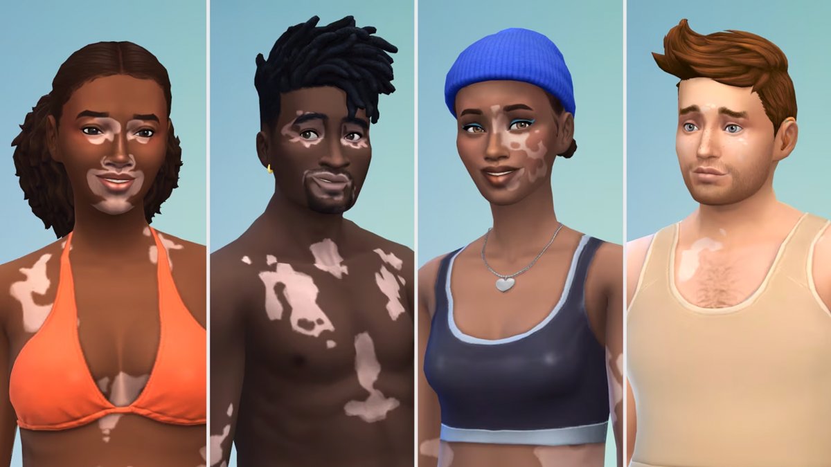 The latest free update to The Sims 4 allows players to add vitiligo skin patterns to their Sims. No less than 61 patterns are included in this update, expanding the features helping players with visible differences feel represented. caniplaythat.com/2024/02/15/the…