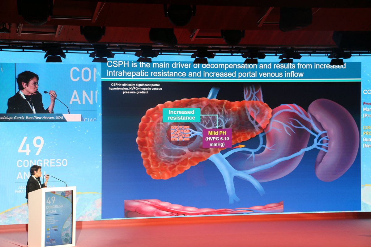 AEEHLiver's tweet photo. ⭐️Momentazo en #AEEH2024 
🗣️Conferencia magistral de @ggarciatsao sobre la progresión y regresión de la cirrosis. 
Todo un lujo contar con ella en nuestro congreso, así nos tiene a todos, sin pestañear
#livertwitter https://t.co/rYGbCyOBoC