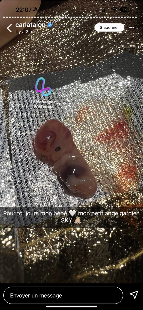 WeScoopfan's tweet photo. C’est quoi ce bordel encore 🥲🤮 #Carlatalon qu’est ce tu fous 🤣 https://t.co/8v7UjG1P0G