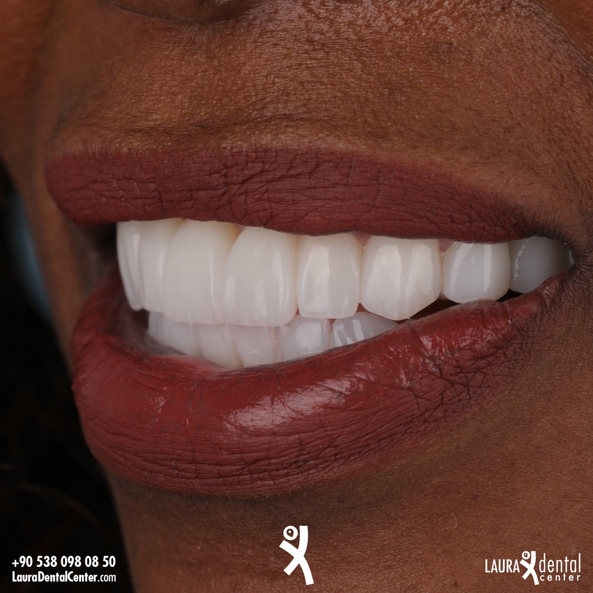 LauraDentalC's tweet photo. https://t.co/UvhENSP5bw