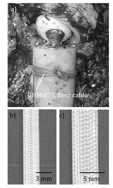 Biomedres01's tweet photo. Optimal Clamping Force of Ultra High Molecular Weight Polyethylene Cable is 15 kgf by Rina Sakai in #BJSTR
https://t.co/Qzc4v1qkLt https://t.co/O59FqvDGKD