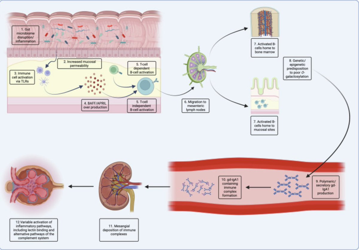 Novel Treatment Paradigms: Primary IgA Nephropathy

doi.org/10.1016/j.ekir…

#KIRReviews #IgANephropathy