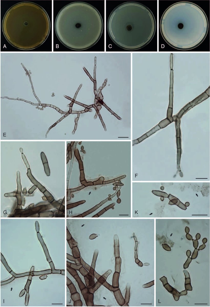 Fungi that grow on Coffee ☕️ Leaf Rust (Hemileia vastatrix) in Africa. doi.org/10.3114/fuse.2… #fungi #Coffee #Coffea #PlantPathogens #mycoparasites @ufvbr @ufvplantpath @CABI_News #JimmaAgriculturalResearchCenter