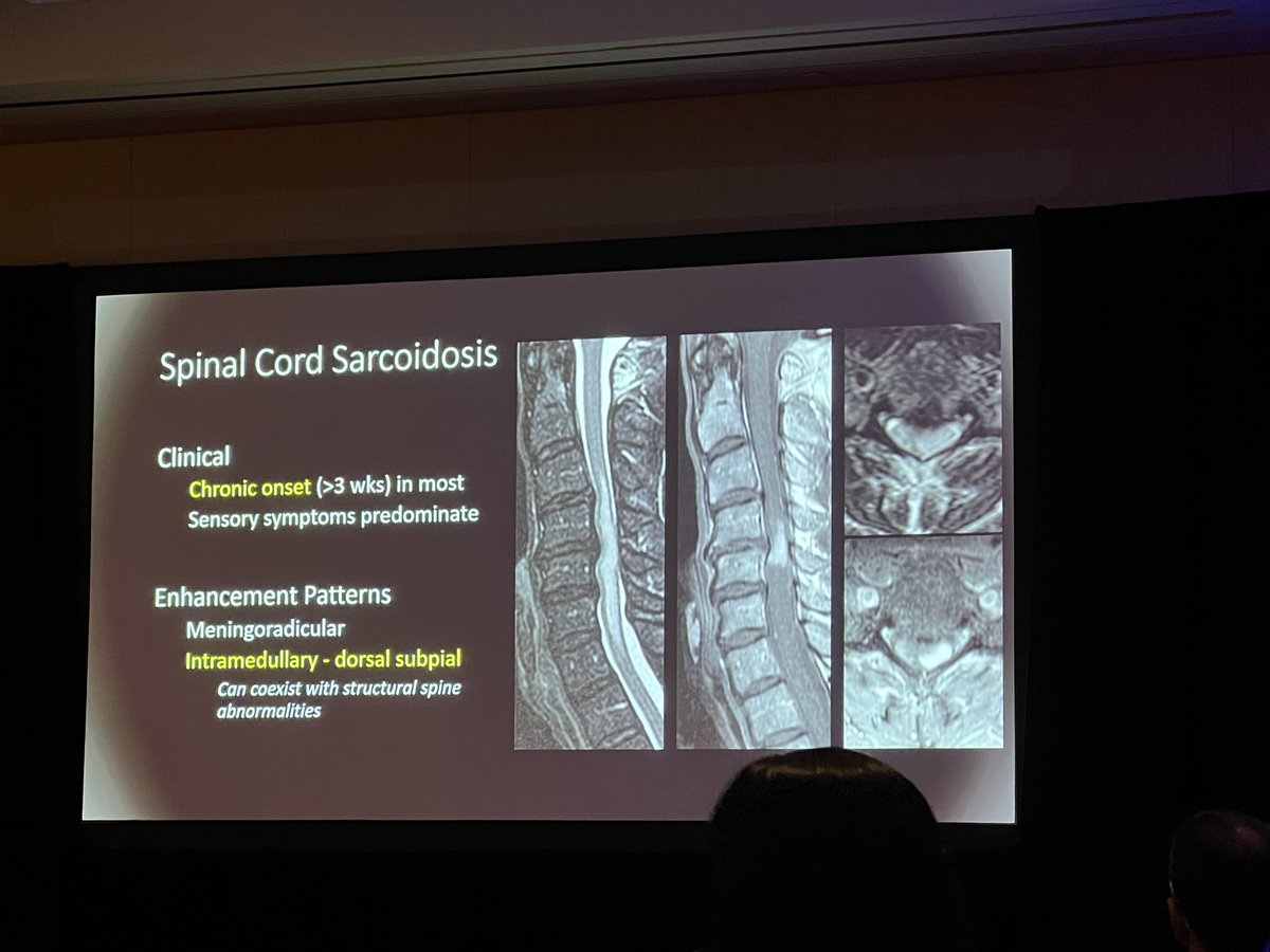 Mentored case session at #ASSR24 with @EricTranvinhMD and fellow Dr. Shin