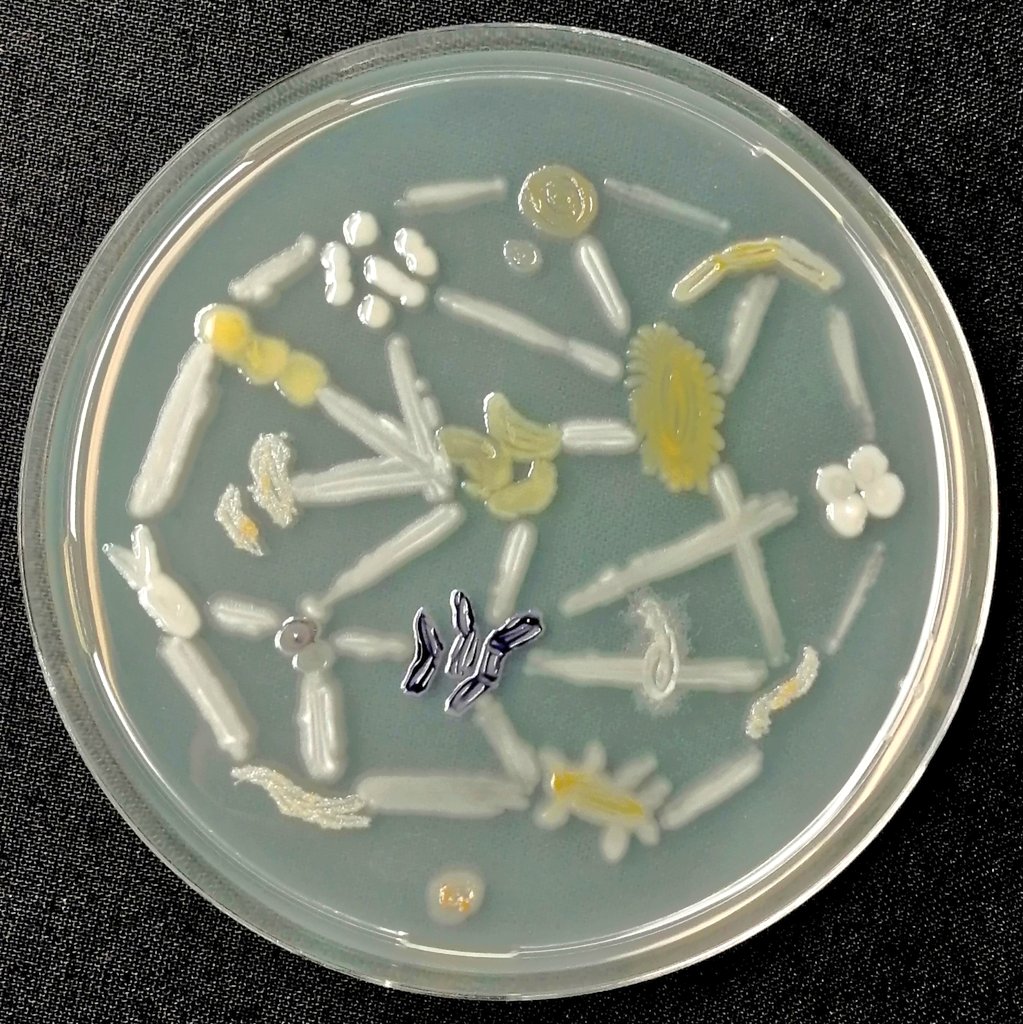 VasviChaudhry's tweet photo. #Culturablemicrobes #Microbialinteractions #Microbialcommunitynetwork #Microbialart #Microbialworld https://t.co/iHVsrAAEZt