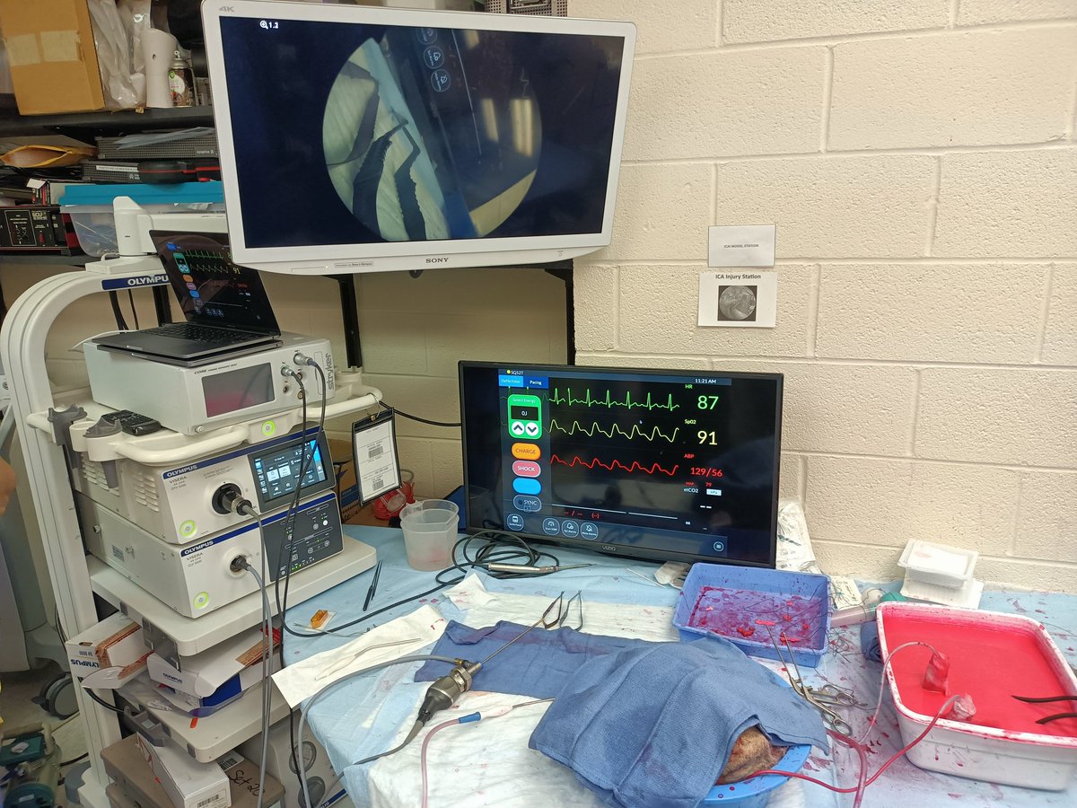 Edoardo Porto, MD (@edoardoporto) on Twitter photo We are back with the ICA injury model at the NASBS pre-meeting course, Atlanta USA!
<a href="/gpradil2/">Gustavo Pradilla</a> <a href="/ManuRevuelta/">Manu Revuelta, MD, PhD</a> <a href="/alerodas23/">Alejandra Rodas, MD</a> <a href="/GarzonMuvdi/">Tomas Garzon-Muvdi</a>
<a href="/EmorySkullBase/">Emory Skull Base Surgery</a> We are back with the ICA injury model at the NASBS pre-meeting course, Atlanta USA!
<a href="/gpradil2/">Gustavo Pradilla</a> <a href="/ManuRevuelta/">Manu Revuelta, MD, PhD</a> <a href="/alerodas23/">Alejandra Rodas, MD</a> <a href="/GarzonMuvdi/">Tomas Garzon-Muvdi</a>
<a href="/EmorySkullBase/">Emory Skull Base Surgery</a>