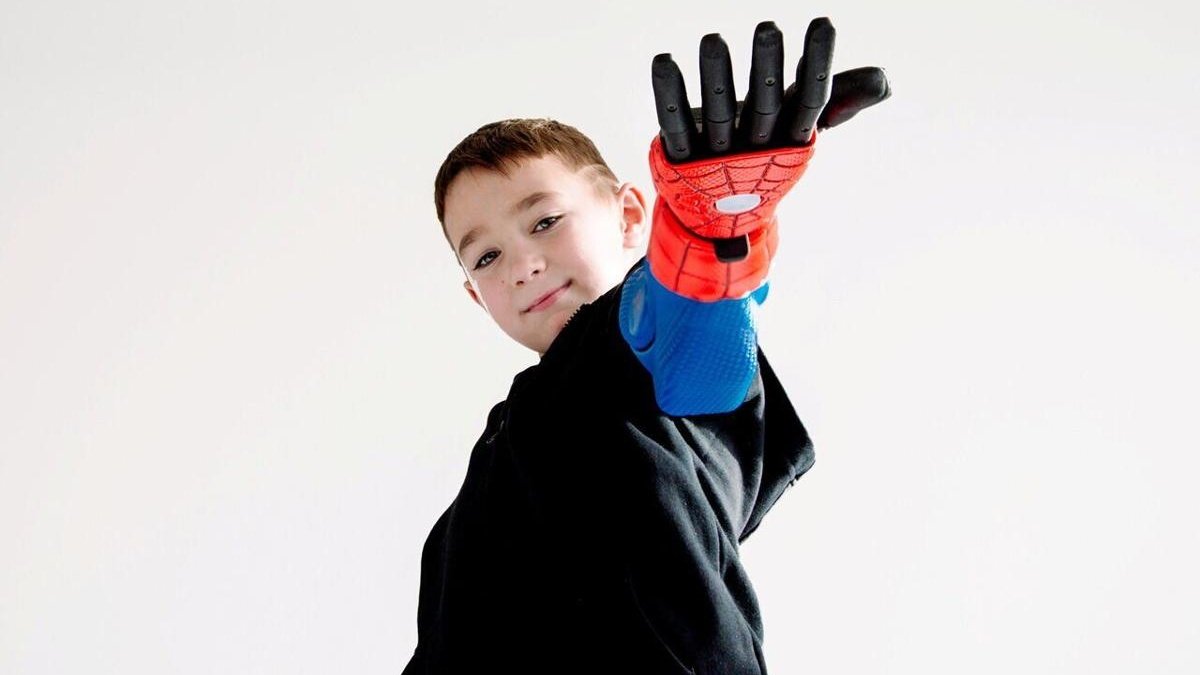 These kids are the first in the world to get special Marvel superhero bionic arms.

The arms have sensors that detect muscular contractions which are then converted to intuitive bionic hand movements.