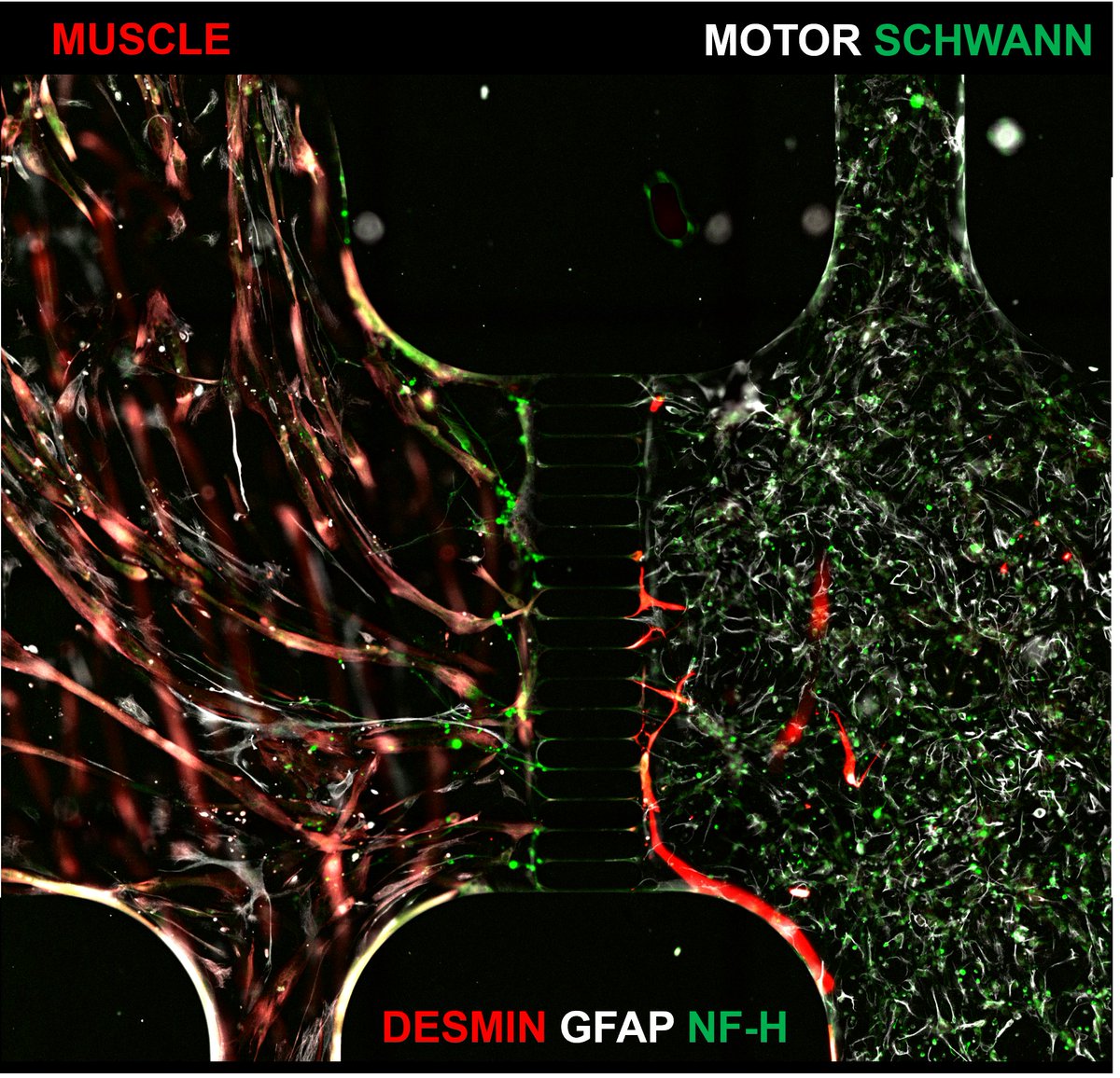 Anatomic is going A N A T O M I C 🤯 In a local collab with the Chan lab at @UMNews, we are developing a same donor tri-culture neuromuscular junction consisting of Schwann cells, motor neurons, and skeletal muscle. #CompletingTheCircuit #NotYourAverageNeuron #alsancaktravesti