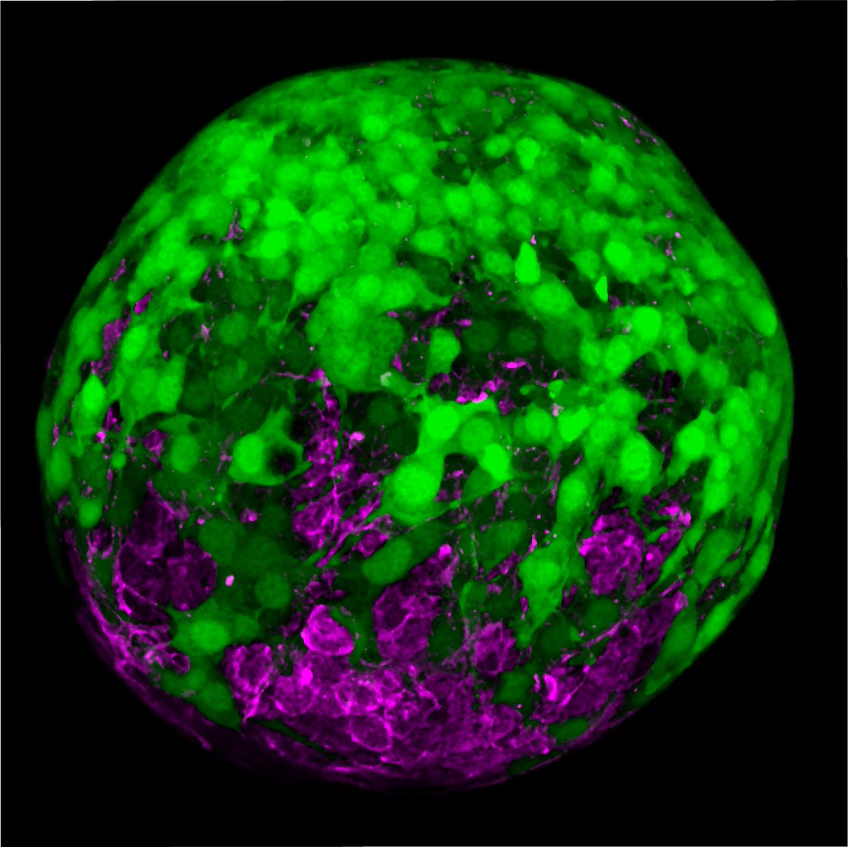 Communications Biology (@commsbio) on Twitter photo A 3D in vitro model shows that compressive stress is required to generate and maintain a fibroblast capsule around cancer spheroids.
<a href="/institut_curie/">Institut Curie</a>, <a href="/DMVlab/">Danijela Matic Vignjevic</a>, <a href="/LP2N_lab/">Laboratoire Photonique Numérique et Nanosciences</a>, <a href="/univ_paris_cite/">Université Paris Cité</a>, <a href="/InstitutOptique/">Institut d'Optique</a>, <a href="/maitrejl/">Jean-Léon Maître</a>, <a href="/BiotherLab/">BiotherLab</a>
nature.com/articles/s4200… A 3D in vitro model shows that compressive stress is required to generate and maintain a fibroblast capsule around cancer spheroids.
<a href="/institut_curie/">Institut Curie</a>, <a href="/DMVlab/">Danijela Matic Vignjevic</a>, <a href="/LP2N_lab/">Laboratoire Photonique Numérique et Nanosciences</a>, <a href="/univ_paris_cite/">Université Paris Cité</a>, <a href="/InstitutOptique/">Institut d'Optique</a>, <a href="/maitrejl/">Jean-Léon Maître</a>, <a href="/BiotherLab/">BiotherLab</a>
nature.com/articles/s4200…