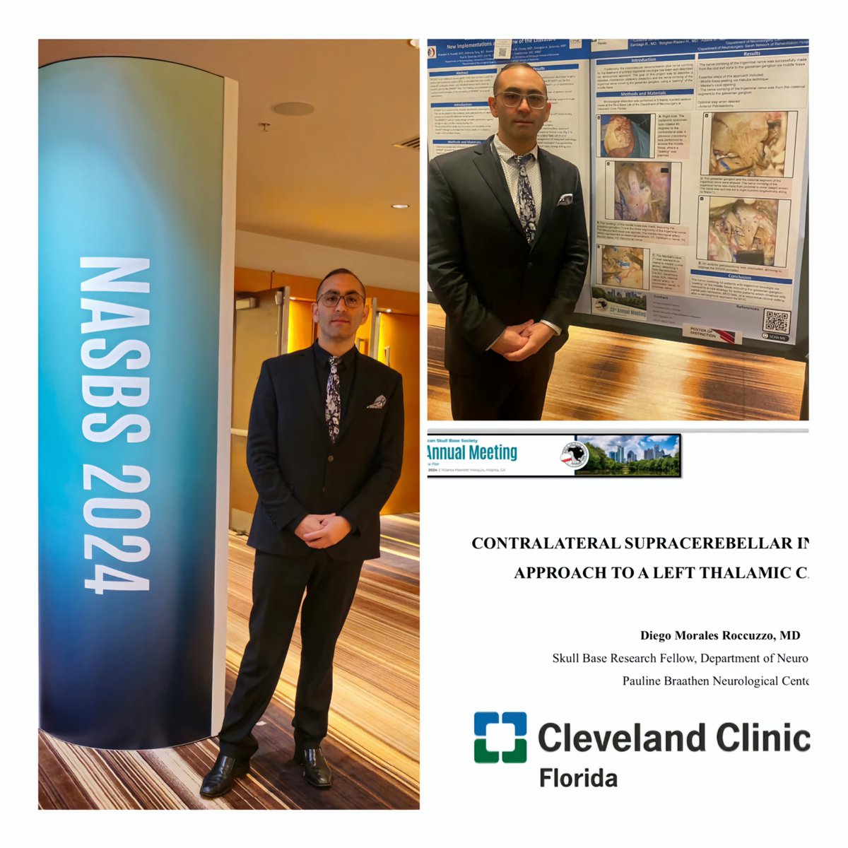 Amazing and awe-inspiring convention with top-notch presenters and state-of-the-art educational lectures. @NASBSorg 2024 @CCFL_BrainTumor @CleveClinicFL @ClevelandClinic Eternal respect for my mentor @DrBadihAdada and my dear program director @BorgheiRazaviMD. True gratitude.