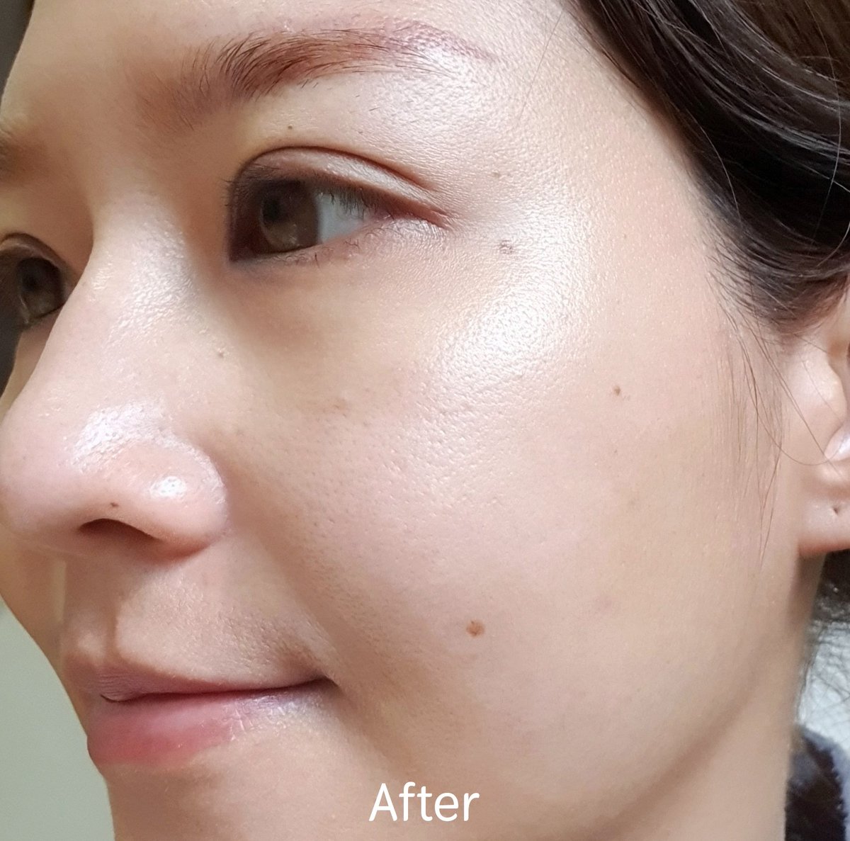 iffieben's tweet image. ตั้งแต่กินวิตามินตัวนี้มา ผิวหน้าดีขึ้นมาก สิวแทบไม่ขึ้นเลย(ต้องบอกก่อนว่าเป็นคนมีสิวผดบ่อย สิวอักเสบมีเป็นบางช่วง) รอยดำจากสิวจางลงแทบไม่เห็นแล้ว เรากินวันละ 2 เม็ดก่อนนอน ต้องทานต่อเนื่องนะ ค่อยจะเห็นผลว่าผิวใสขึ้นจริง #nectapharma #HowtoPerfect