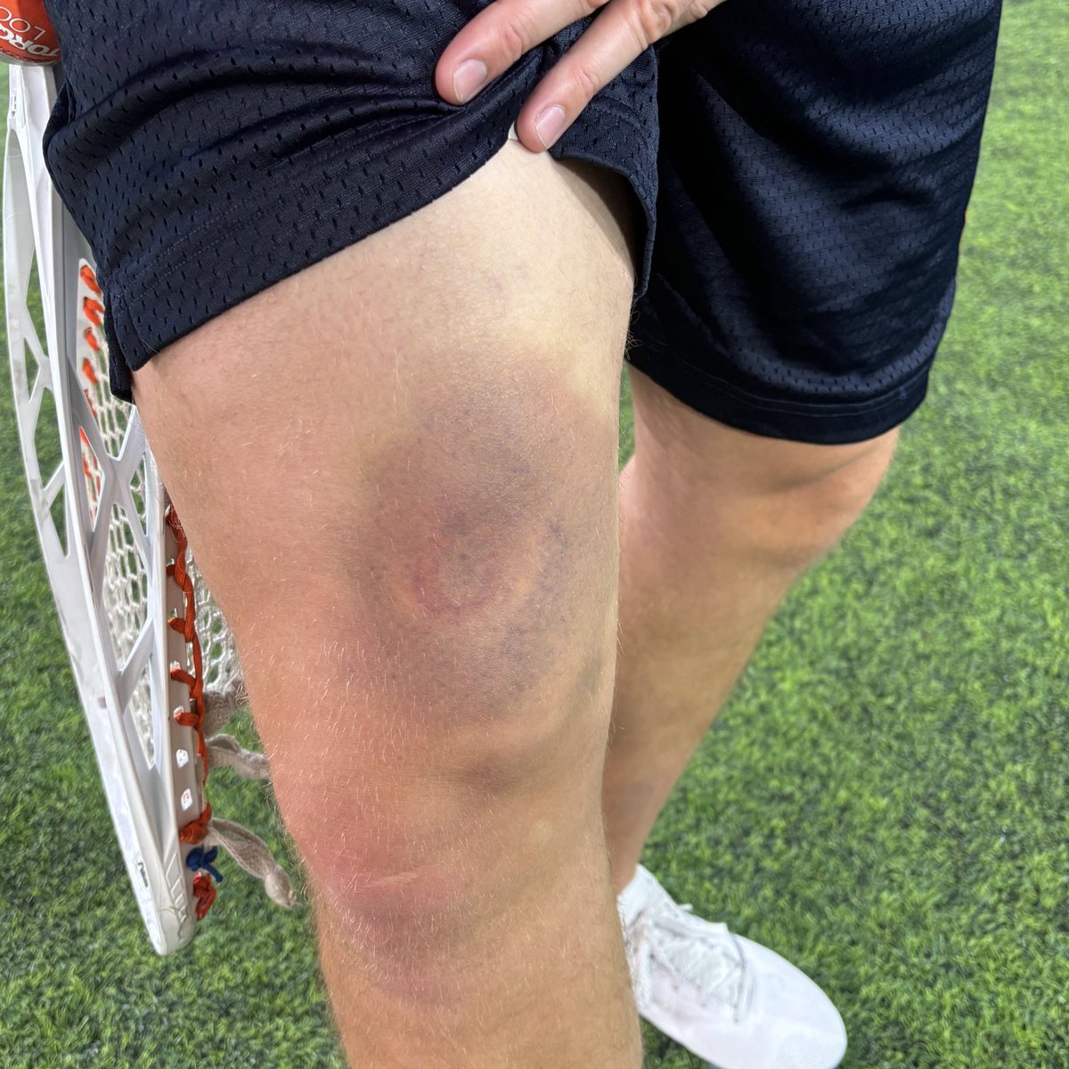 PLLArchers's tweet photo. .@NickWashuta had a night last night 😳 https://t.co/JdQB0mnCf8