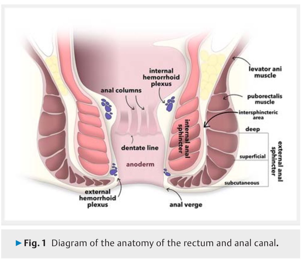 GIscope_updates's tweet photo. EUS of the rectum &amp; anal canal

✅ https://t.co/yt8LmaEnVv https://t.co/3EENGR31j9