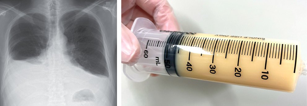 Keith Siau tweet media