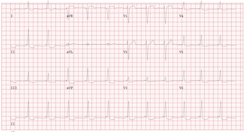 Mike Manogue tweet media