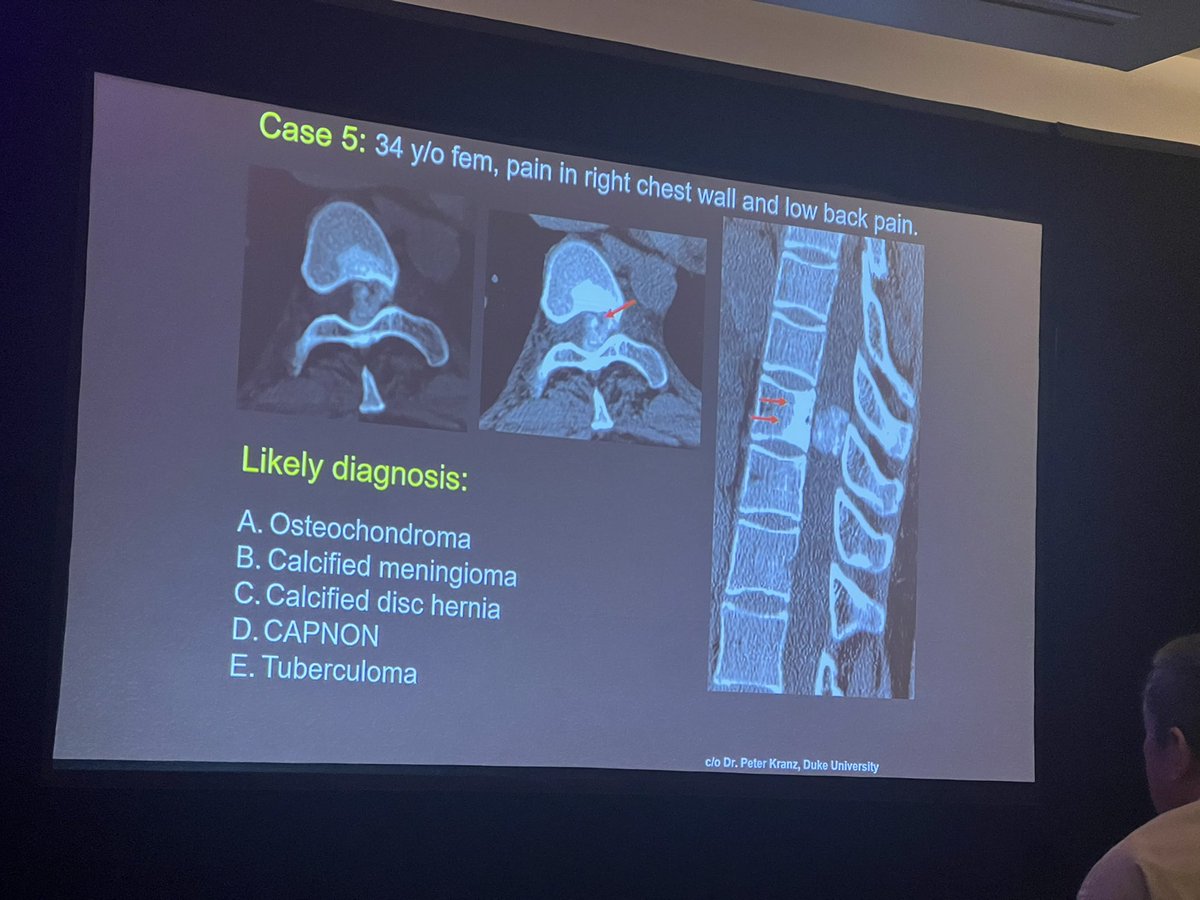 Anousheh Sayah (@anoushehsayah) on Twitter photo Cool cases! Learned some nice tips for unusual studies. Thanks Carlos! Only <a href="/The_ASSR/">American Society of Spine Radiology (ASSR)</a> #carlostorres <a href="/PeterGKranz/">Peter Kranz</a> Cool cases! Learned some nice tips for unusual studies. Thanks Carlos! Only <a href="/The_ASSR/">American Society of Spine Radiology (ASSR)</a> #carlostorres <a href="/PeterGKranz/">Peter Kranz</a>