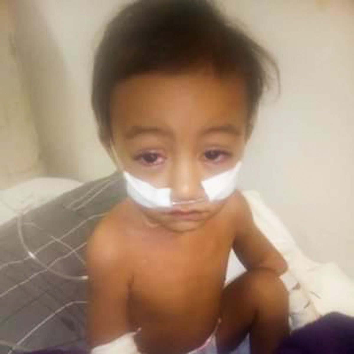 GetSchwifyinere's tweet photo. Robert Kennedy Jr.‘s company, Children’s Health Defense, launched an anti-vaccine campaign with Australian-Samoan anti-vaccine activist Taylor Winterstein in June 2018 in Samoa. They hosted anti-vaccine seminars, charging $200 a ticket, to discuss the purported dangers of the MMR vaccine, spreading misinformation that it causes autism. Despite scientific evidence disproving any link between the vaccine and autism, their campaign led to a significant drop in vaccination rates; only 31% of infants received the measles vaccine, a decline from 70% and 60% in previous years.

The situation was exacerbated when two boys died from complications not directly related to the MMR vaccine itself but due to a tragic error: two nurses accidentally mixed the vaccine with a liquid muscle relaxant. Following this incident, the measles vaccination program was halted, and the two nurses were charged with manslaughter, receiving five-year prison sentences.

In October 2019, Samoa was hit by a severe measles epidemic that resulted in the deaths of 82 infants. Among the first 70 fatalities, 61 were babies aged four and under, and all but seven were under 15.

Kennedy did not publicly address the incident involving the two nurses until months later. He also wrote a letter to the Samoan government urging them to investigate the MMR vaccine further.

This is the individual running for President.
