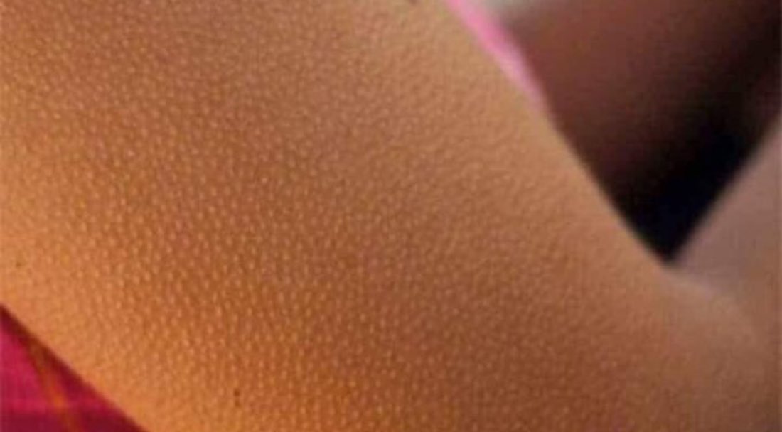 Beijinho no pescoço a:

Eu: