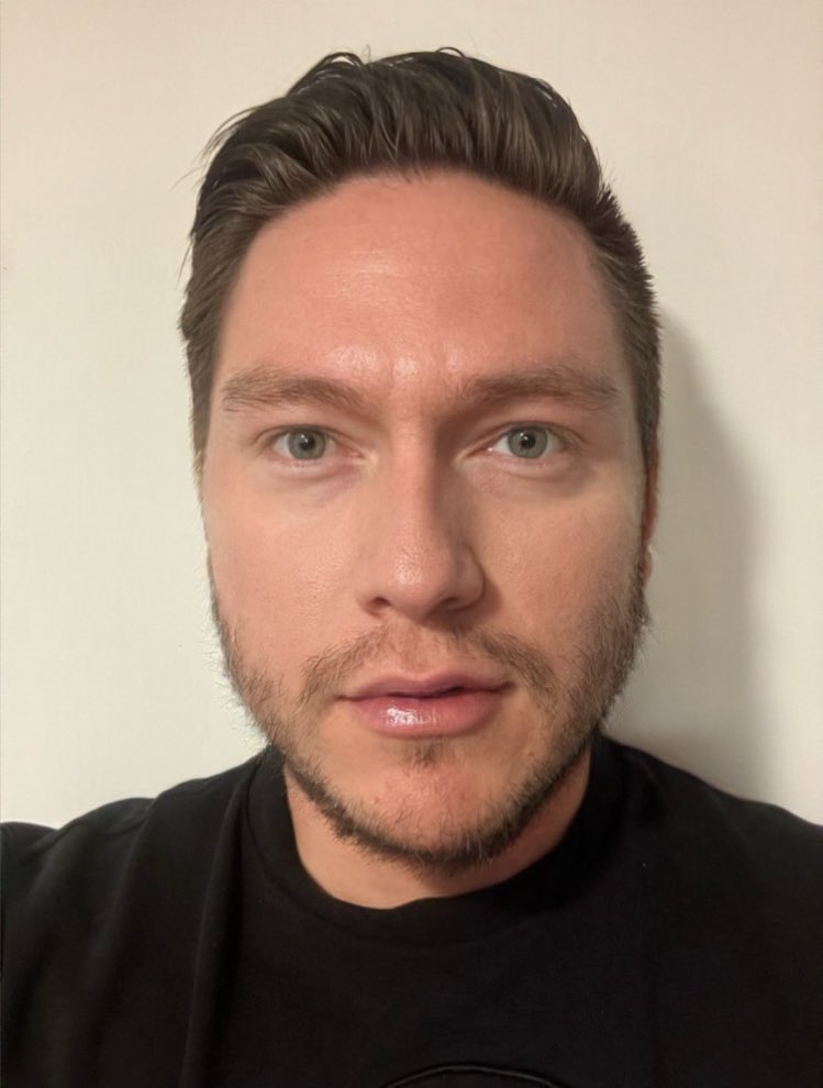 erksovi's tweet photo. Ya me sale más barba 😮‍💨🤙🏻 https://t.co/vuoe1KZHj0
