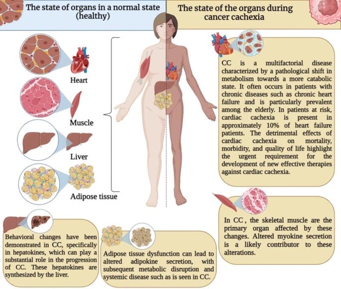 PauloBergerot's tweet photo. Gr8 review on #exerkines &
Good #exercise guide for individuals w #cancer #cachexia.
@BMC_series @BioMedCentral
#exerciseismedicine #oncology #exerciseoncology
https://t.co/K6kAsLVMSr https://t.co/Ayn6YXxp77